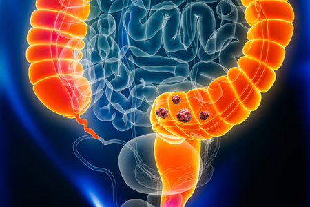 Colon or large intestine cancer with organs and tumors or cancerous cells 3D rendering illustration. Anatomy, oncology, bowels disease, medical, biology, science, healthcare concepts.の写真素材