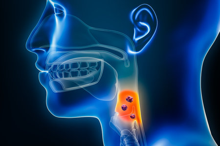 Laryngopharynx or throat cancer with organs and tumors or cancerous cells 3D rendering illustration. Anatomy, oncology, pharynx disease, medical, biology, science, healthcare concepts.の写真素材