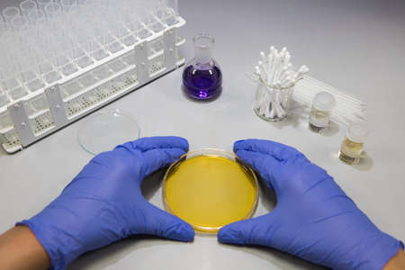 Microbiologist in a laboratory analysing bacteria samples on a plate. Scientist working in a biology...