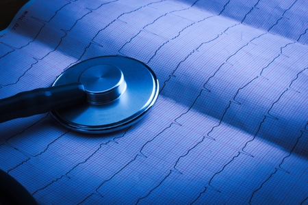 Stethoscope on an electrocardiogram (ECG) chart backgroundの写真素材