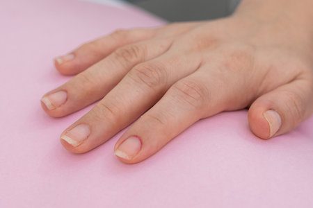 close-up detail of a girl's hand, placed on a pink background, woman's right hand with untidy nails ready to start cleaning and painting in the beauty salon. ready to apply nail polish.の写真素材