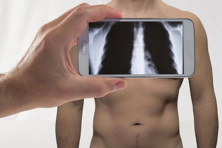 a man and his specular imaging radiographic view through the smart phoneの写真素材