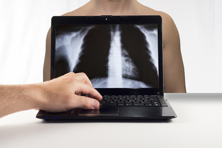 a man and his specular imaging radiographic view through the computerの写真素材