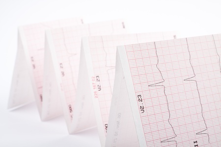 Photo of real electrocardiogram graphの写真素材