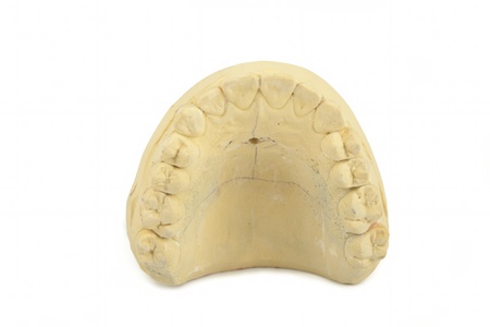 Teeth gypsum model isolated on white background