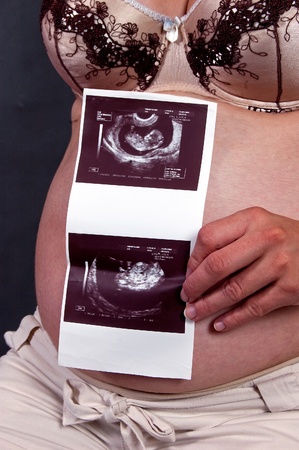 Pregnant woman holding ultrasound resultの写真素材
