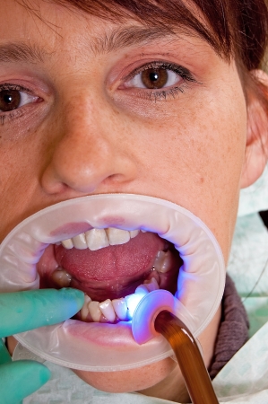 Dental treatment in a young woman in a dentist's officeの写真素材