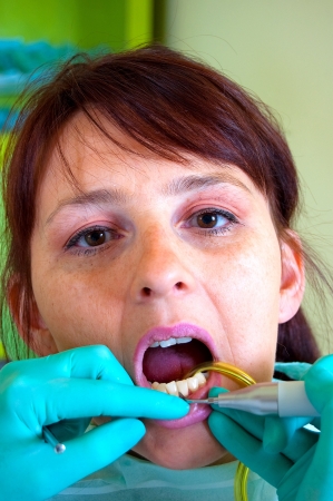 Dental treatment in a young woman in a dentist's officeの写真素材