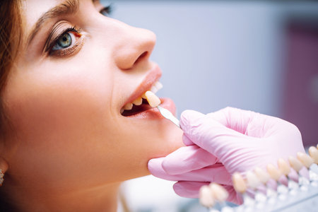 Young woman at the dentist's chair during a dental procedure. Overview of dental caries prevention.の写真素材