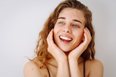 Close-up portrait of a beautiful woman without makeup with imperfect skin. Acne skin. Natural beautyの写真素材