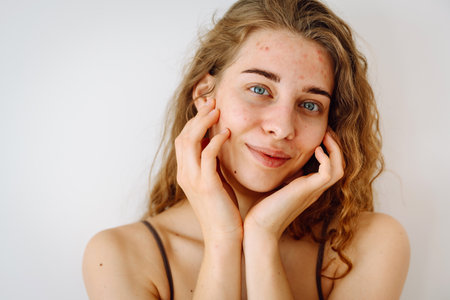 Cute woman with rashes on her face looks into a small mirror. Natural beauty. Cosmetology, care.の写真素材