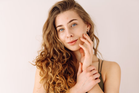 Portrait of a beautiful woman with inflammations on the skin of her face. Medicine and cosmetology.の写真素材