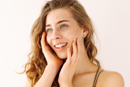 Portrait of a beautiful young woman with inflammations on the skin of her face. Acne disease.