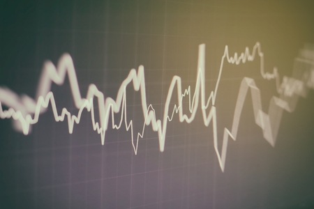 Stock market chart. Business graph background. Forex trading. business concept in color
