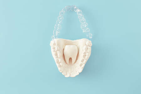 Orthodontic dental theme on blue background.Transparent invisible dental aligners or braces aplicable for an orthodontic dental treatmentの写真素材