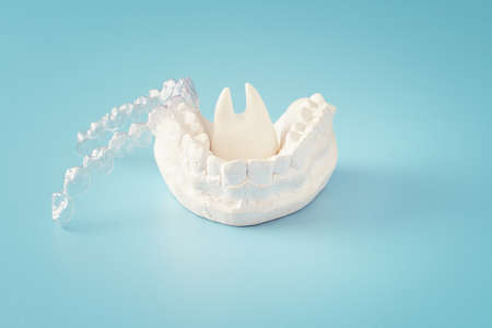 Orthodontic dental theme on blue background.Transparent invisible dental aligners or braces aplicable for an orthodontic dental treatmentの写真素材