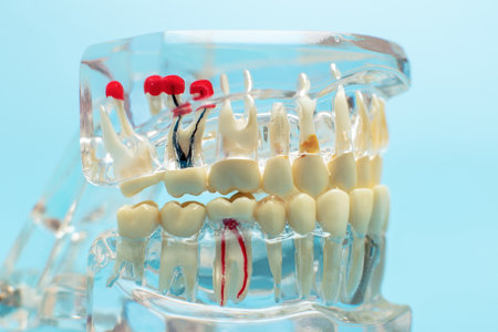 Compare tooth model and tooth model with metal wire dentalの写真素材