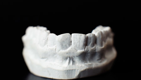 Dental jaw model over black background. Dentist dental prosthetic teeth, gums, roots close-up.の写真素材