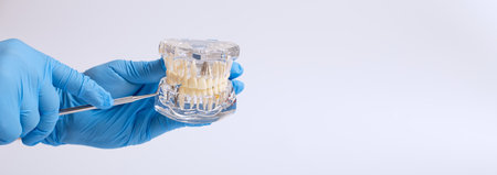 In hand dentists dental teeth teaching model showing each tooth, gum, root, implant, decay, plaque and enamel.の写真素材