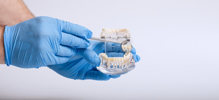 In hand dentists dental teeth teaching model showing each tooth, gum, root, implant, decayの写真素材