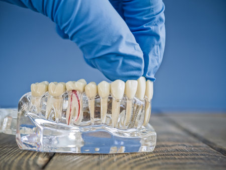 Side View of a Dental Implant Model with a Gloved Hand Adjusting Prosthetic Teeth on a Transparent Jawの写真素材
