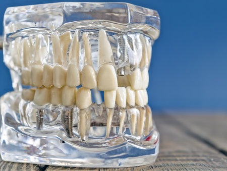 Full-Side View of a Transparent Dental Implant Model Featuring Artificial Teethの写真素材