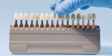 Close-up of a gloved hand selecting a tooth shade from a dental color guide, used for matching...