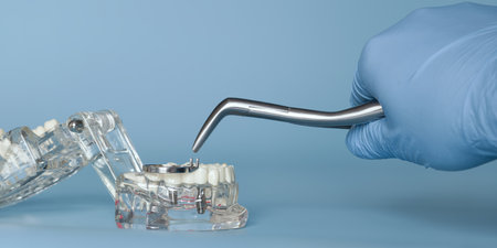 Dental implant model with surgicalの写真素材