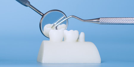 Dental bridge model with examinationの写真素材