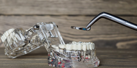 Dental root canal model with metal inspectionの写真素材