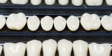Dental crowns and prosthetic teethの写真素材