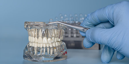 Demonstration of a dental implant withの写真素材