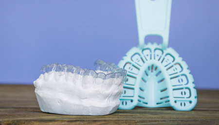 Clear orthodontic aligner placed on a plaster dental mold, with an impression tray in the background...