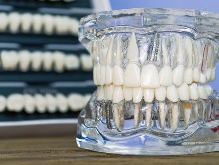 Dental implant model with tooth sets in background