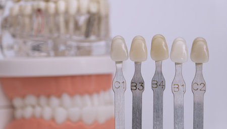 Close-up of a dental shade guide with labeled tooth samples used for selecting the correct color in...