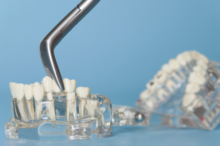 Dental forceps extracting tooth from modelの写真素材
