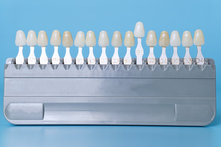 Close-up of a dental shade guide displaying various tooth colors used for matching crowns, veneers, and other restorations.の写真素材