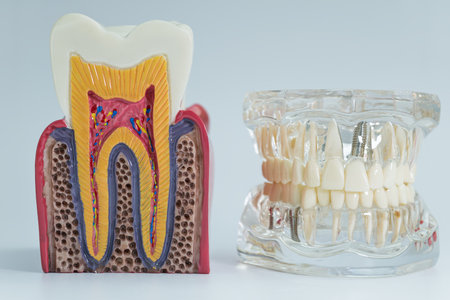 Educational dental models showing internal tooth structure and dental implants used for medical...