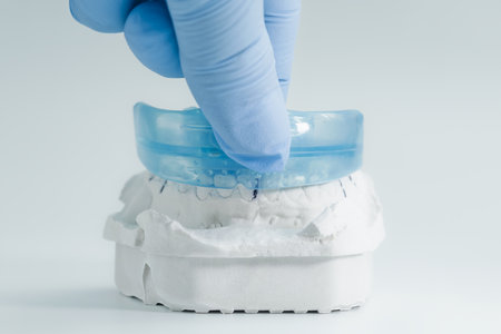 Close-up of a gloved hand placing a transparent blue dental mouthguard onto a white plaster model of...