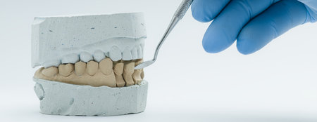 Gloved hand using dental tool on a stone tooth mold, illustrating precision work in prosthodontics and crown preparation.の写真素材