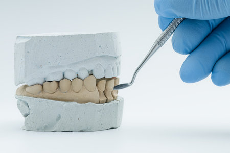 Gloved hand using dental tool on a stone tooth mold, illustrating precision work in prosthodontics...