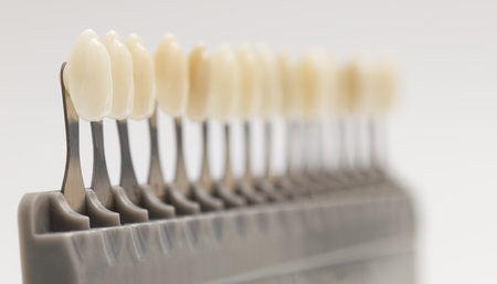 Close-up of a dental shade guide showing various tooth colors used by dentists to match crowns,...