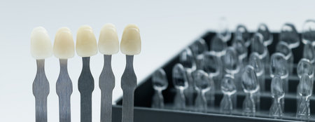 Close-up of five dental shade tabs used for tooth color selection in front of a transparent mold...
