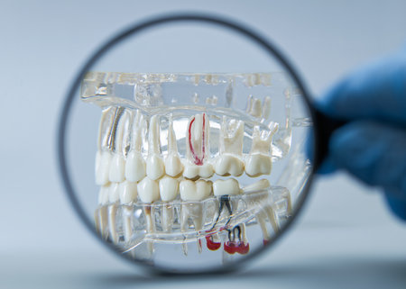A clear anatomical dental model showing teeth and implants is viewed through a magnifying glass, highlighting oral structure and implant placement.の写真素材