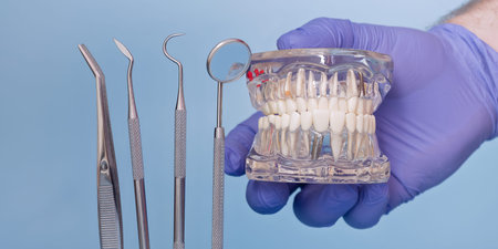 Dental Implant Jaw Model with Dentist Tools in Blue Medical Glove on Light Blue Background