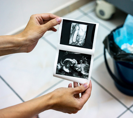 Woman's hands showing scan 3D photo of the unborn child with ultrasound machine. Top view close-upの写真素材