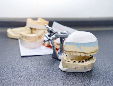 Dental molds and models with prosthetic teeth for cermet in the dental lab