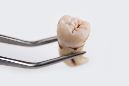 Pulled out adult tooth in the tweezer on a whiteの写真素材