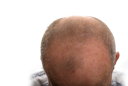 Top of a bold head of  an old male on a whiteの写真素材