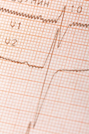 Electrocardiogramの写真素材